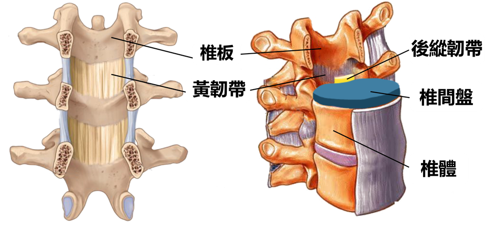 Spinal Stenosis